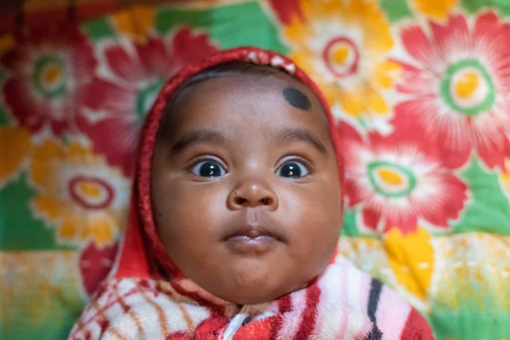 Baby Borna who lives in Bangladesh.